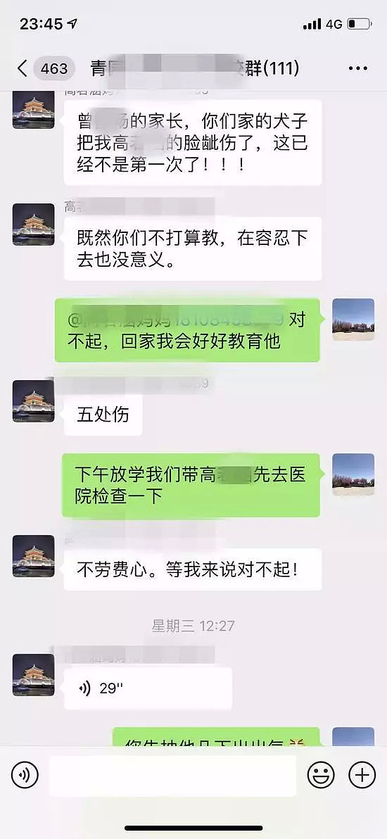 女儿多次被打伤，长沙妈妈两巴掌打掉7岁男孩门牙，正确处置方式是...（组图） - 2