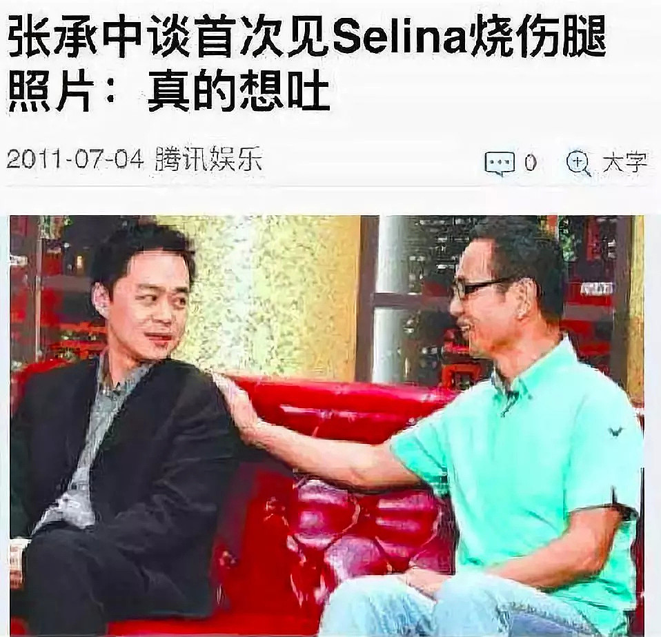 丈夫偷腥不止还说看到她想吐，烧伤毁容曾深陷抑郁，如今终于站起来！（视频/组图） - 27