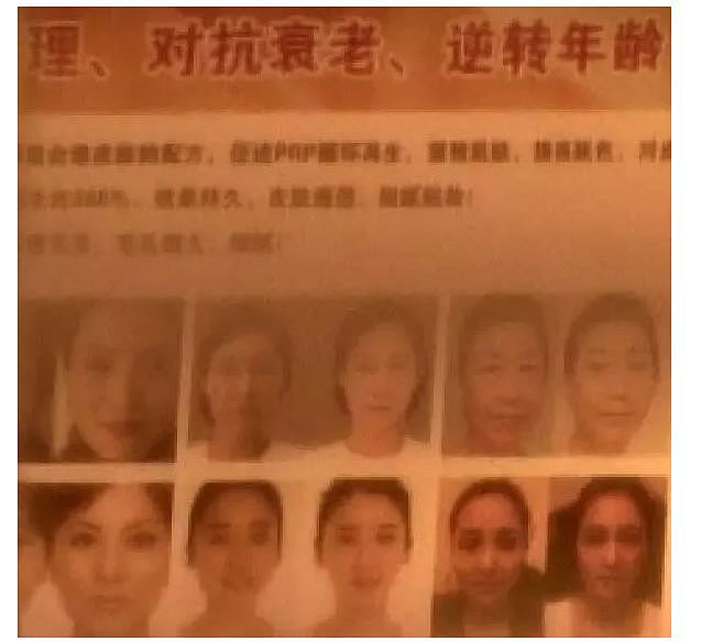 中国女子海外隆胸惨死同胞手术台上，男友当场崩溃！加拿大19岁女留学生更狠（组图） - 15