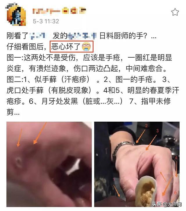 网红日料店厨师手上带“疮”操作！看吐网友，当事人回应说……