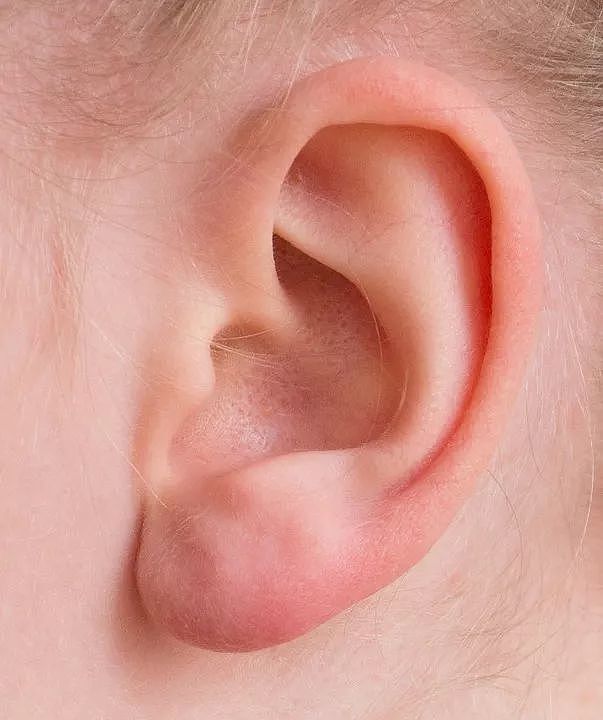 耳道离脑子不远 | pixabay