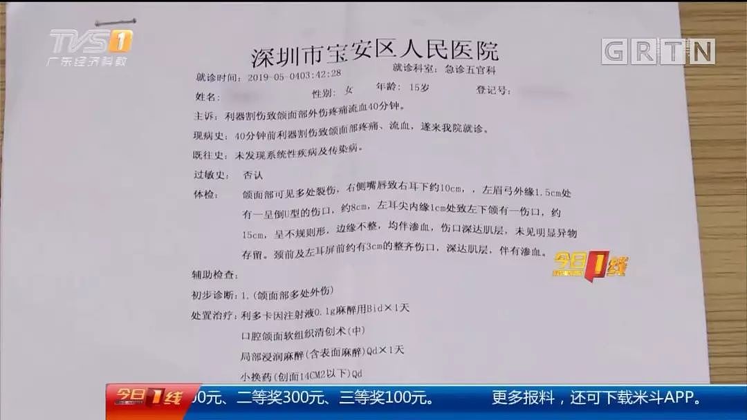 15岁少女拒绝男子求爱被毁容 脸部缝70针（视频/组图） - 3