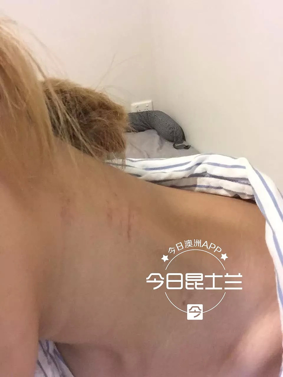 “得到我的身体就变了！”澳中国女留学生自曝遭家暴！涉事男友悲鸣：苦（组图） - 1