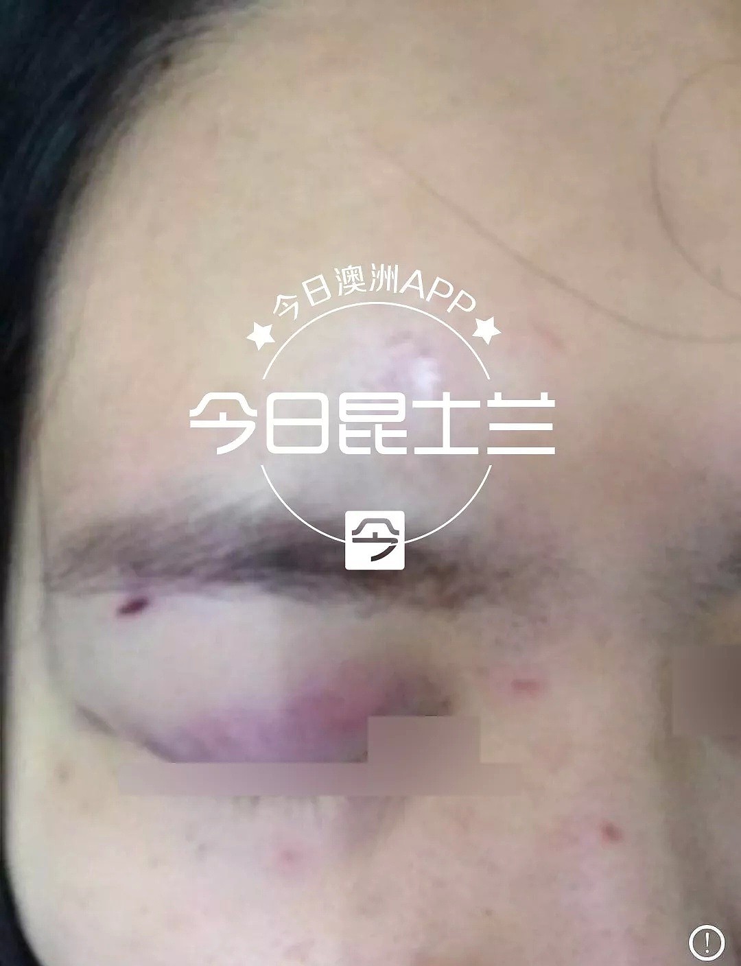 深夜惊魂！澳中国女留学生免费搭乘白人女孩，反遭暴力劫车！被打满脸血（组图） - 11