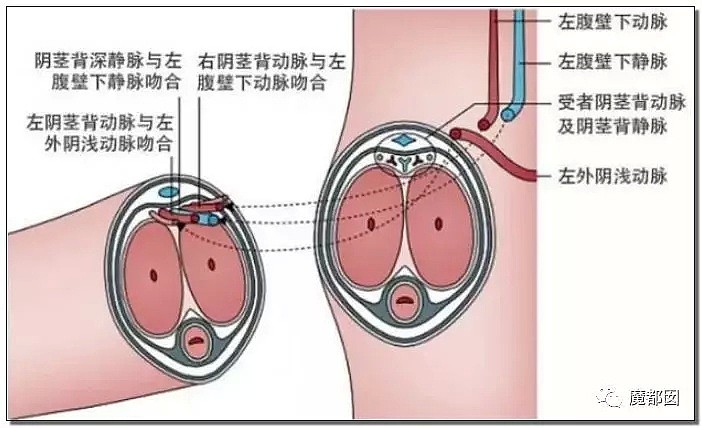 脸羞红！中国完成世界首例男性DD移植手术，结果却狗血反转（组图） - 8