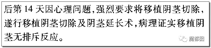 脸羞红！中国完成世界首例男性DD移植手术，结果却狗血反转（组图） - 14