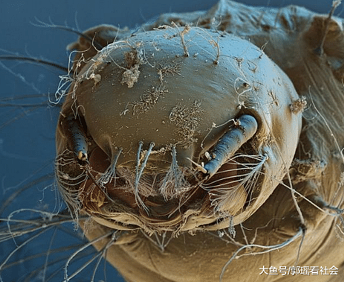 科学家用高倍显微镜观察蚊子的吸食形态，网友直呼被吓到了（组图） - 5