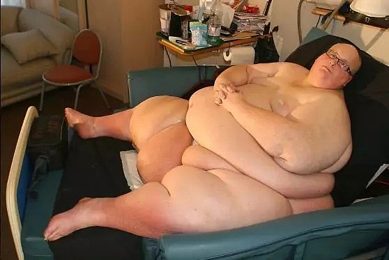 世界最胖的男人想免费治疗，网友们炸毛：凭啥？（组图） - 6