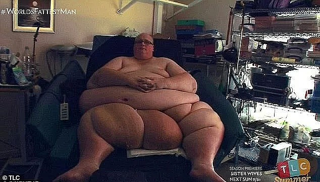 世界最胖的男人想免费治疗，网友们炸毛：凭啥？（组图） - 12