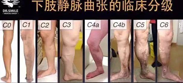 这里，总有穿“丝袜”的男人出没，原因你想不到（组图） - 2