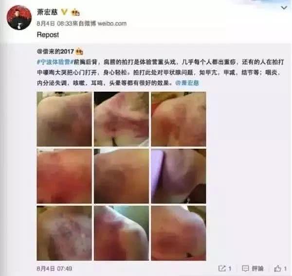 每天暴走2万步，害惨了多少中国人，你还再继续吗？