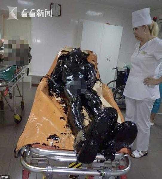 俄男子掉进废弃柏油池 护士用剃须刀刮去脏物
