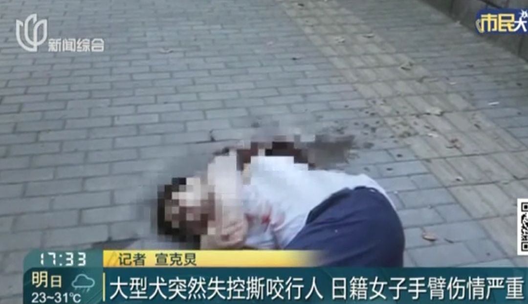 日本人遭中国大型犬撕咬 受伤女：不是狗的问题（视频/组图） - 3