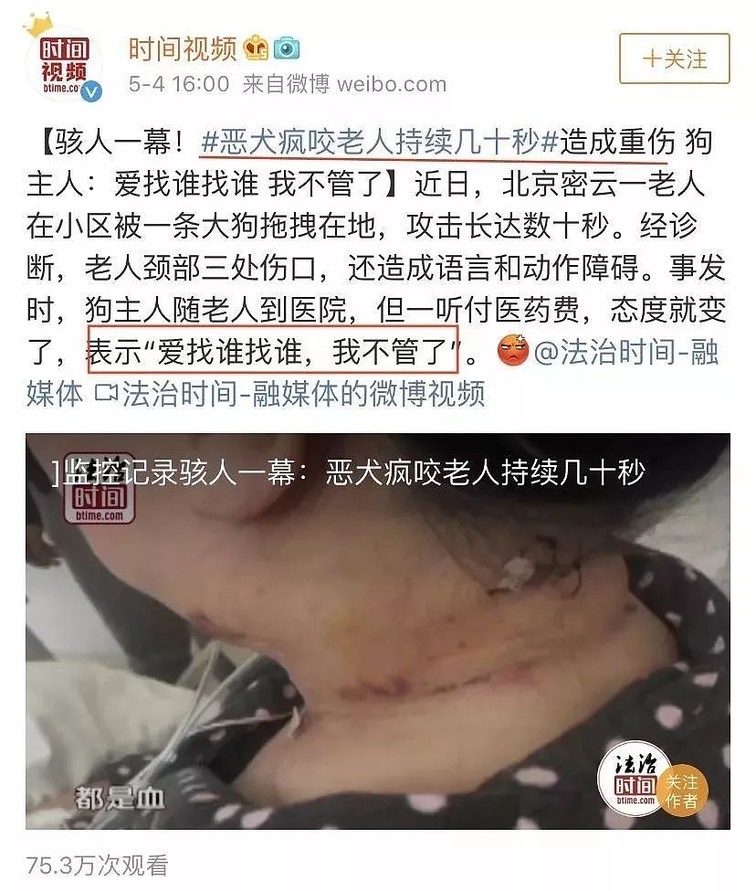 日本人遭中国大型犬撕咬 受伤女：不是狗的问题（视频/组图） - 35