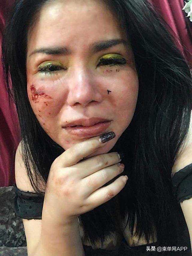 “他像个疯子般毒打我！”柬埔寨网红美女自爆遭高官虐待