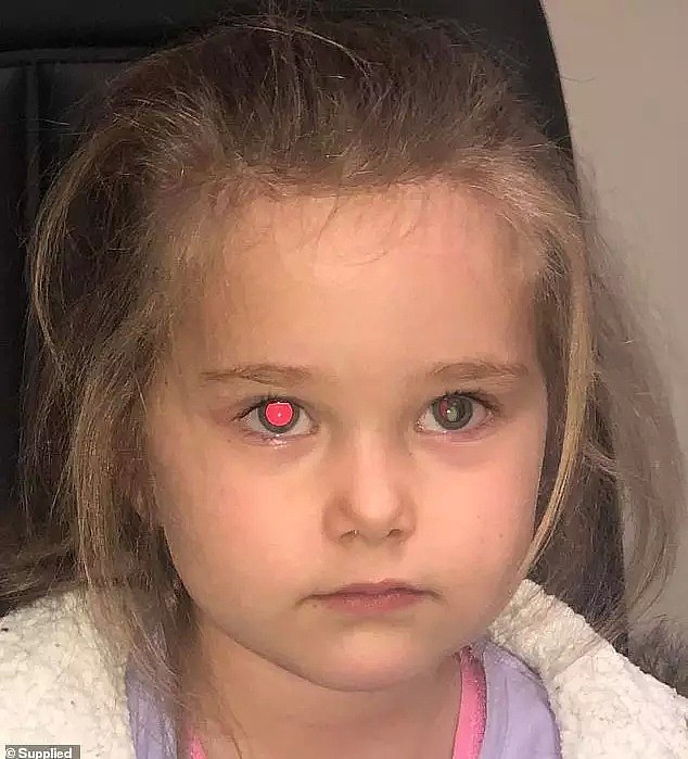 “一定要开闪光灯！”澳洲妈妈拍照救了4岁女儿一命！眼睛出现白点可能是癌症信号！ - 2