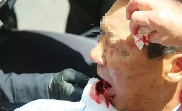恐怖！多名中国游客在美遇袭，光天化日下闹市遭殴打砍伤（组图） - 2