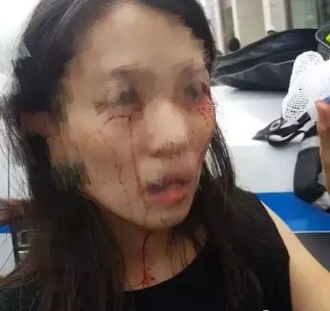 恐怖！多名中国游客在美遇袭，光天化日下闹市遭殴打砍伤（组图） - 9