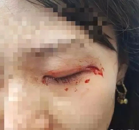 恐怖！多名中国游客在美遇袭，光天化日下闹市遭殴打砍伤（组图） - 10