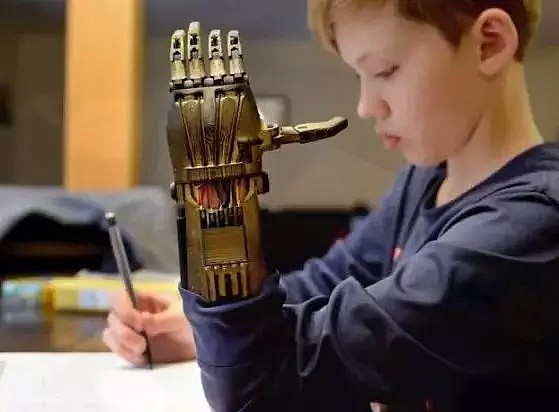 澳洲“赛博朋克机械手臂”竟是由这个不起眼的小玩意做的，助力无数残疾孩子圆梦“超级英雄” - 4