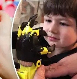澳洲“赛博朋克机械手臂”竟是由这个不起眼的小玩意做的，助力无数残疾孩子圆梦“超级英雄” - 8