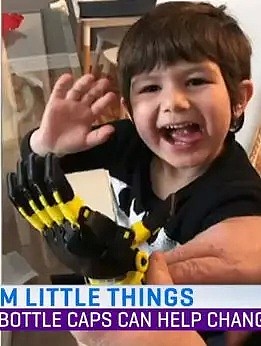 澳洲“赛博朋克机械手臂”竟是由这个不起眼的小玩意做的，助力无数残疾孩子圆梦“超级英雄” - 9