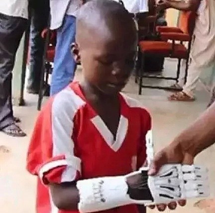 澳洲“赛博朋克机械手臂”竟是由这个不起眼的小玩意做的，助力无数残疾孩子圆梦“超级英雄” - 12