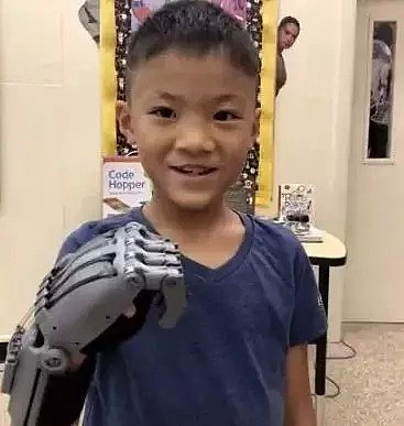 澳洲“赛博朋克机械手臂”竟是由这个不起眼的小玩意做的，助力无数残疾孩子圆梦“超级英雄” - 19