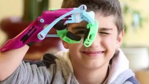 澳洲“赛博朋克机械手臂”竟是由这个不起眼的小玩意做的，助力无数残疾孩子圆梦“超级英雄” - 26