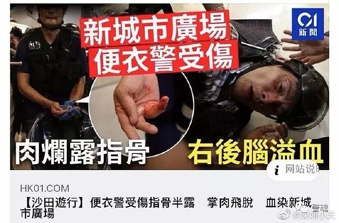 触目惊心！港独暴徒钳断香港警察手指，这是CIA惯用手段（组图） - 8