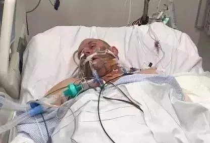 吃了一口这个，华女截肢、有人全身溃烂而死！人人都可能感染，死亡率超高！（组图） - 14