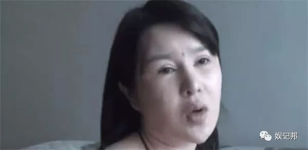 花27万找韩国医生整容，假体上移至脖子，女子：我还未出嫁啊！（组图） - 3