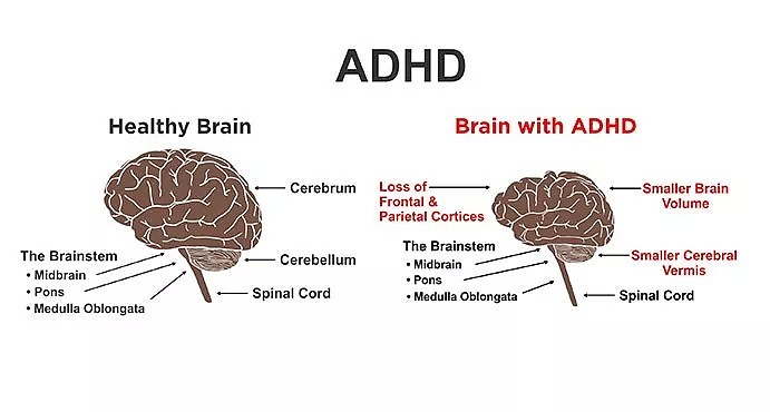 ​赶紧看看吧！当中国父母还在纵容孩子做这件事时，澳洲政府已经下达了最强禁令… - 14