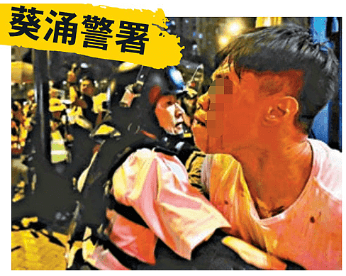 大批示威者集结围堵警署 24名香港警员遭袭5人送医（组图） - 3