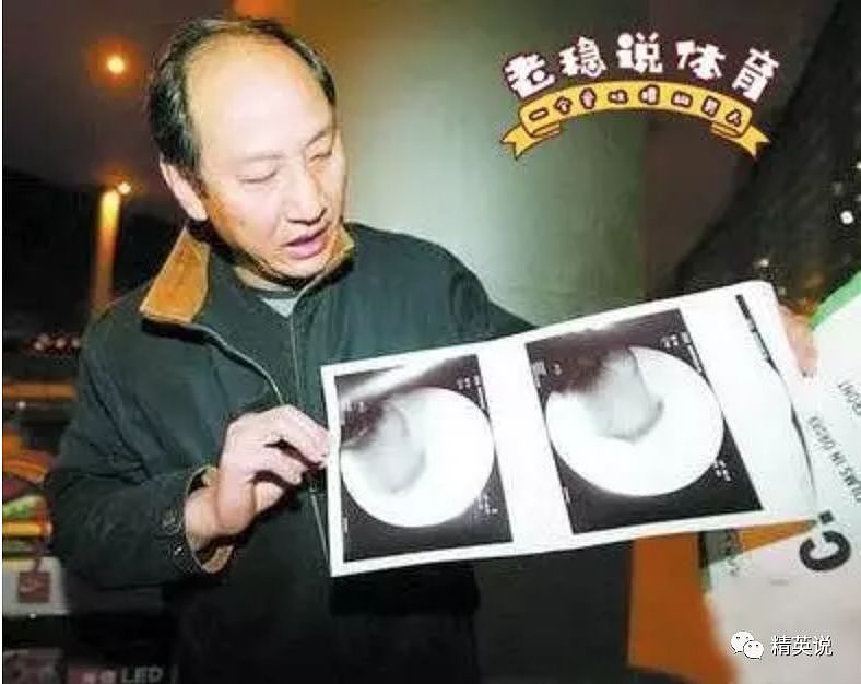 李宁被寄刀片、傅园慧被骂垃圾，20年过去，我们为何不能接受奥运英雄的失败？（组图/视频） - 19