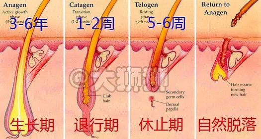 产后脱发是什么“鬼”！放任不管，真会变秃顶？... - 3