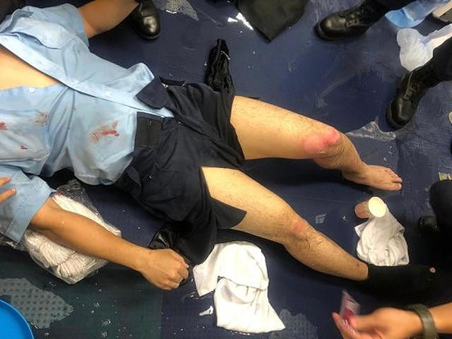 香港英籍“爆头警司”：暴徒在伞尖绑着刀，13岁女儿受威胁