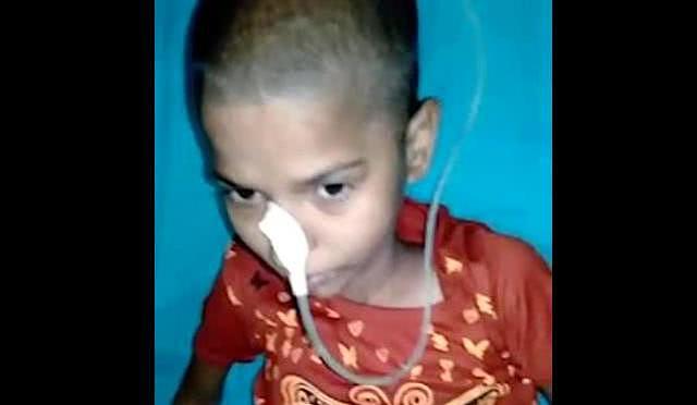14岁印度女孩因胃痛被送往医院，结果发现她胃里有个巨大毛球