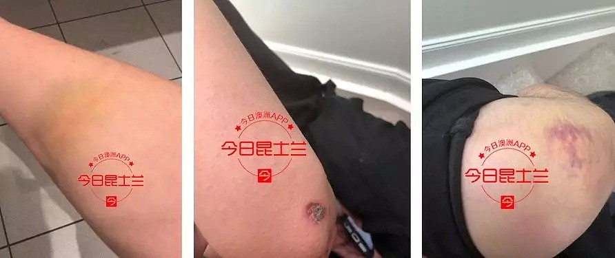 澳中国女留学生当街遭围殴抢手机，男友胳膊打脱臼！犯事teenager前科累累 - 8