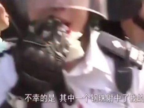 香港高级督察遭示威者打碎门牙 现场画面曝光（组图） - 1