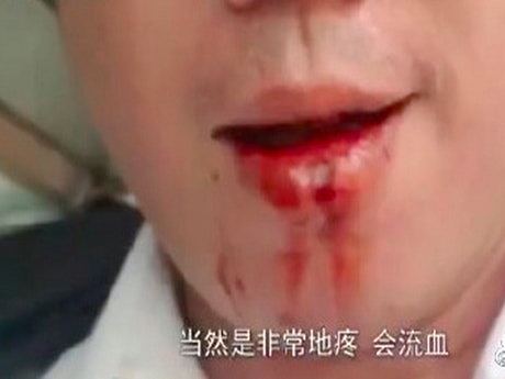 香港高级督察遭示威者打碎门牙 现场画面曝光（组图） - 3