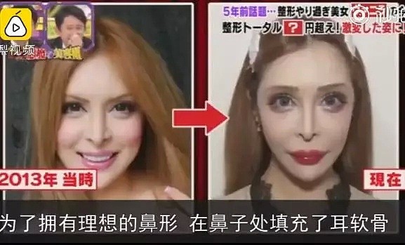 日本女星一心想成为法国洋娃娃，狂砸2亿日元整容超过100次...（组图） - 7