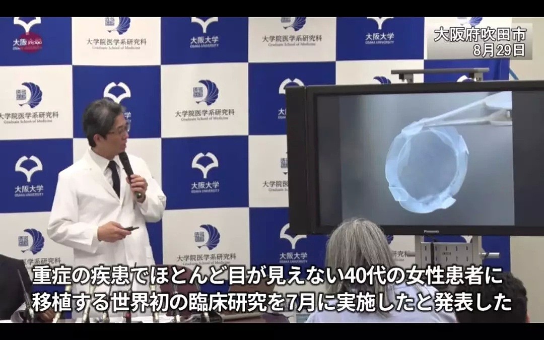 全球首例！日本成功移植iPS眼角膜，40岁盲女恢复视力！（组图） - 8