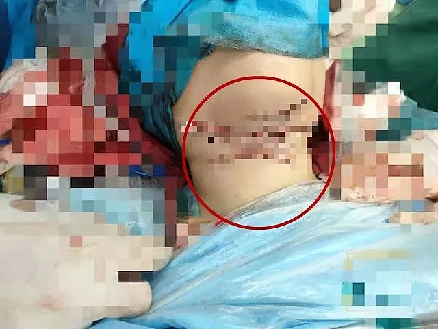 22岁女孩遭割喉7刀！一番冷静自救让她保住了命（组图） - 4