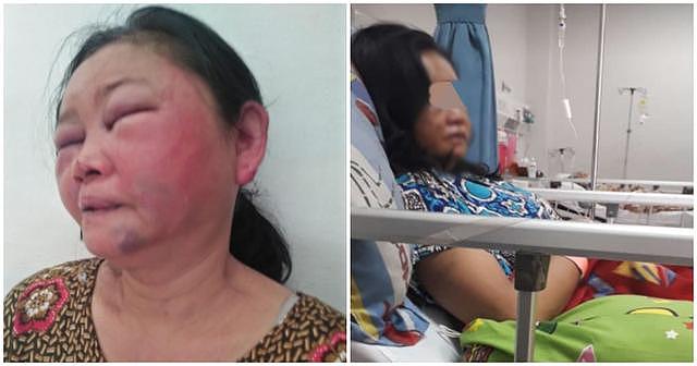 印尼妻容忍老公偷腥甚至让带情妇回家，苦苦挽留却被打成“猪脸”