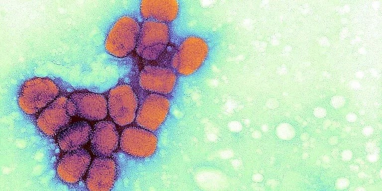 生化危机? 俄罗斯实验室爆炸 大量致命病毒恐外泄（组图） - 7