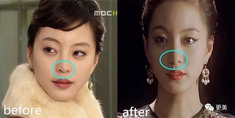 韩国第一人造美女，怼导演承认换头，40岁复出冻龄似20，整的太成功（组图） - 59