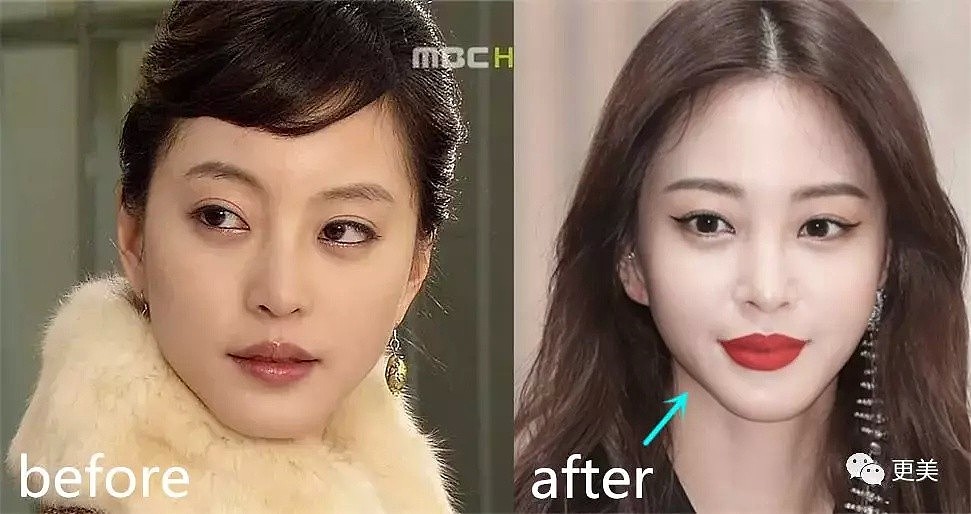 韩国第一人造美女，怼导演承认换头，40岁复出冻龄似20，整的太成功（组图） - 65