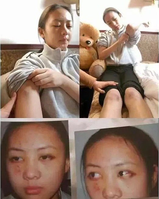 又一小花官宣结婚！被前男友当众暴打遭封杀，这次找了个大17岁老公，要翻身了（组图） - 11