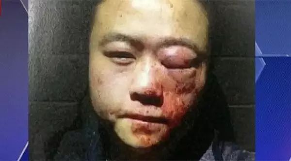 注意！澳华女在火车站被陌生男子持刀袭击！遇到这些人，千万要远离！（组图） - 13